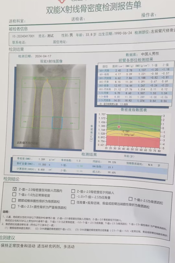 雙能X射線骨密度儀：準確測量骨密度，助力骨質疏松防治，守護骨骼健康